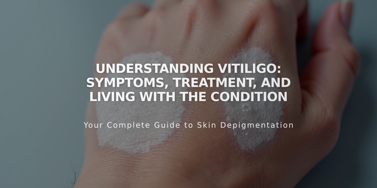 Understanding Vitiligo: Symptoms, Treatment, and Living with the Condition