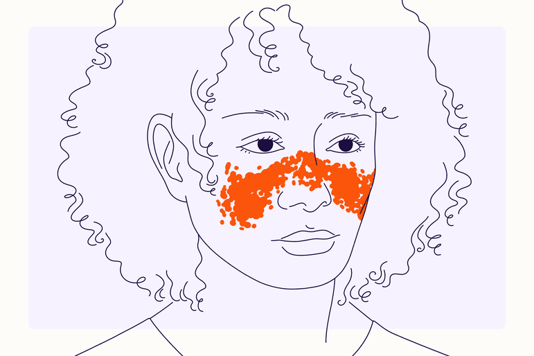 Facies feminae illustrata cum lupus