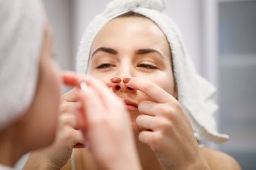 Woman squeezing facial pimple