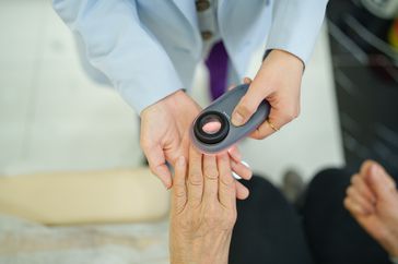 Doctor examining skin with magnifying glass