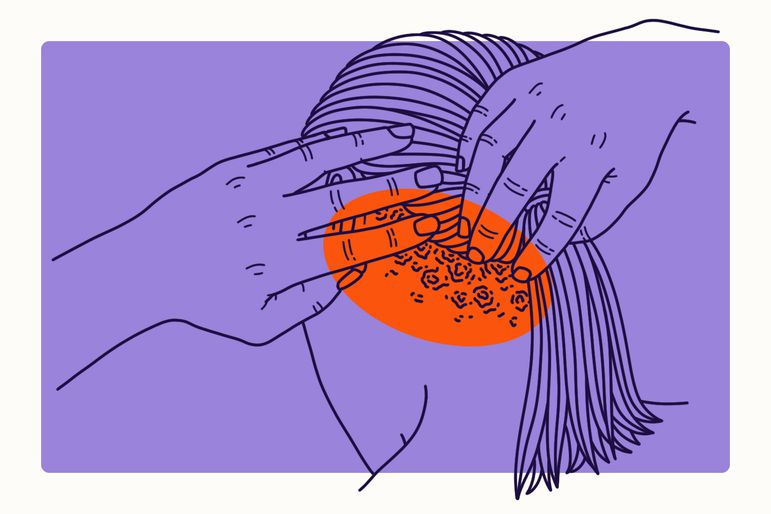 Hands examining scalp with red patches